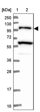 Lane 1: Marker [kDa] 250, 130, 95, 72, 55, 36, 28, 17, 10_br/_Lane 2: Human cell line RT-4