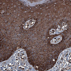 Immunohistochemical staining of human skin shows strong cytoplasmic positivity in squamous epithelial cells.