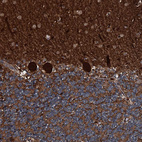 Anti-TRIM7 Antibody