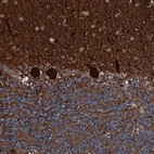 Immunohistochemical staining of human cerebellum shows strong cytoplasmic positivity in Purkinje cells.