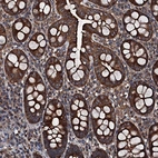 Immunohistochemical staining of human colon shows strong cytoplasmic positivity in glandular cells.