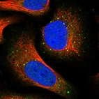 Immunofluorescent staining of human cell line U-2 OS shows localization to nucleoplasm, cytosol & vesicles.