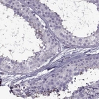 Immunohistochemical staining of human testis shows high expression.