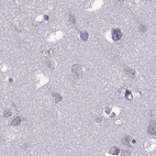 Immunohistochemical staining of human cerebral cortex using Anti-ODF3 antibody HPA039241.