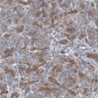 Anti-POLR1D Antibody