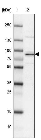 Lane 1: Marker [kDa] 250, 130, 100, 70, 55, 35, 25, 15, 10_br/_Lane 2: Human cell line MOLT-4