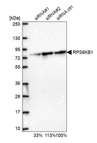 Western blot analysis in U2OS cells transfected with control siRNA, target specific siRNA probe #1 and #2, using Anti-RPS6KB1 antibody. Remaining relative intensity is presented.