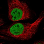 Immunofluorescent staining of human cell line U-2 OS shows localization to nucleoplasm.