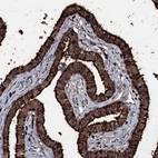 Anti-OGFOD2 Antibody