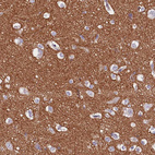 Immunohistochemical staining of human cerebral cortex shows strong cytoplasmic/ cytoplasmic membranous positivity in neuropil.