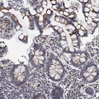 Immunohistochemical staining of human small intestine shows moderate membranous positivity in glandular cells.