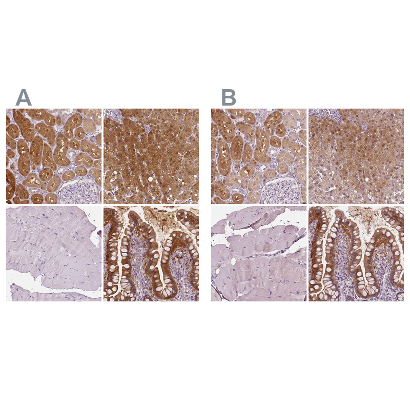 Anti-TKFC Antibody