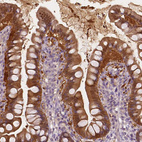 Immunohistochemical staining of human small intestine shows strong cytoplasmic positivity in glandular cells.