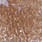 Immunohistochemical staining of human liver shows strong cytoplasmic positivity in hepatocytes.