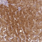 Immunohistochemical staining of human liver shows strong cytoplasmic positivity in hepatocytes.