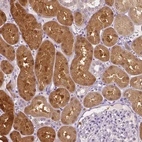 Immunohistochemical staining of human kidney shows strong cytoplasmic positivity in cells in tubules.
