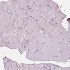 Immunohistochemical staining of human skeletal muscle shows no positivity in myocytes as expected.