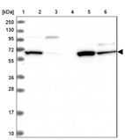 Lane 1: Marker [kDa] 250, 130, 95, 72, 55, 36, 28, 17, 10_br/_Lane 2: Human cell line RT-4_br/_Lane 3: Human cell line U-251MG sp_br/_Lane 4: Human plasma (IgG/HSA depleted)_br/_Lane 5: Human liver tissue_br/_Lane 6: Human tonsil tissue