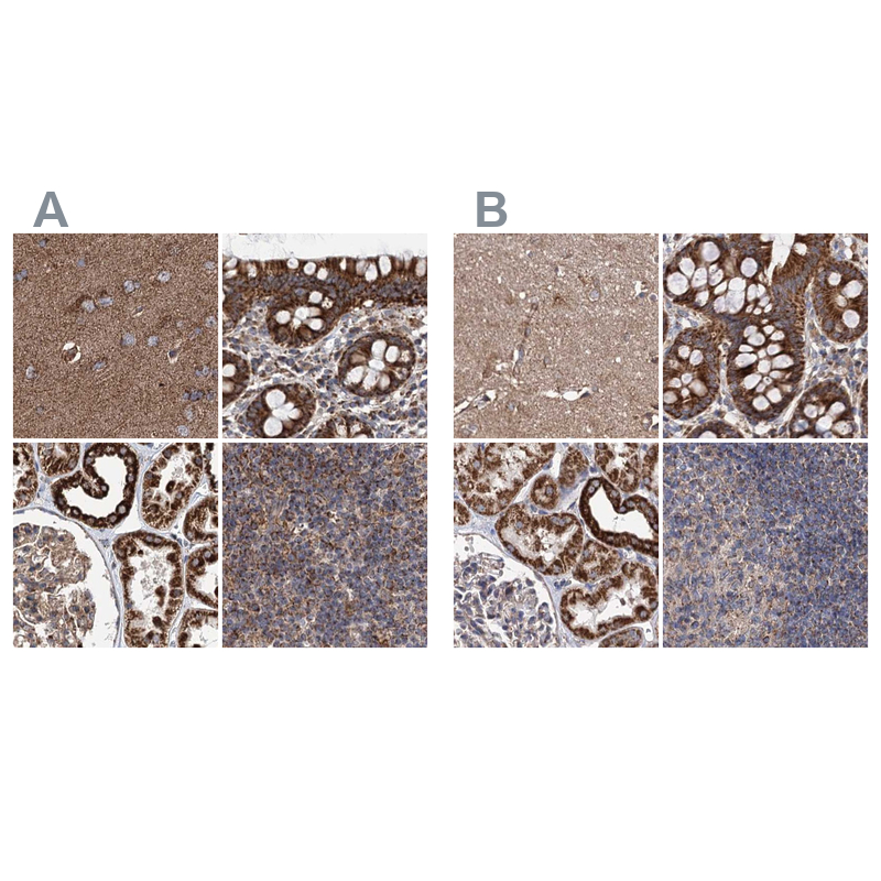 Anti-SUCLA2 Antibody