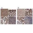 Anti-SUCLA2 Antibody