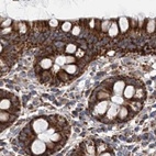 Immunohistochemical staining of human colon using Anti-SUCLA2 antibody HPA039536.