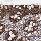 Immunohistochemical staining of human colon using Anti-SUCLA2 antibody HPA039536.