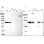 Western blot analysis using Anti-SUCLA2 antibody HPA039536 (A) shows similar pattern to independent antibody HPA039435 (B).
