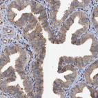 Immunohistochemical staining of human fallopian tube shows moderate cytoplasmic positivity in glandular cells.