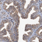 Immunohistochemical staining of human fallopian tube shows moderate cytoplasmic positivity in glandular cells.
