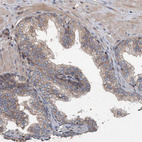 Immunohistochemical staining of human prostate shows weak cytoplasmic positivity in glandular cells.