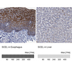 Anti-SCEL Antibody
