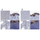 Immunohistochemical staining of human liver, skin, testis and tonsil using Anti-SCEL antibody HPA039737 (A) shows similar protein distribution across tissues to independent antibody HPA040154 (B).
