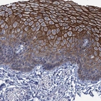 Immunohistochemical staining of human esophagus shows strong membranous positivity in squamous epithelial cells.