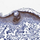 Immunohistochemical staining of human skin shows moderate to strong cytoplasmic and membranous positivity in squamous epithelial cells.