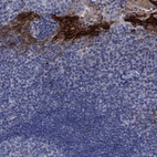 Immunohistochemical staining of human tonsil shows strong cytoplasmic and membranous positivity in squamous epithelial cells.