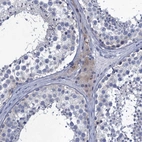 Immunohistochemical staining of human testis shows weak cytoplasmic positivity in Leydig cells.
