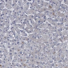 Immunohistochemical staining of human liver shows no positivity in hepatocytes as expected.