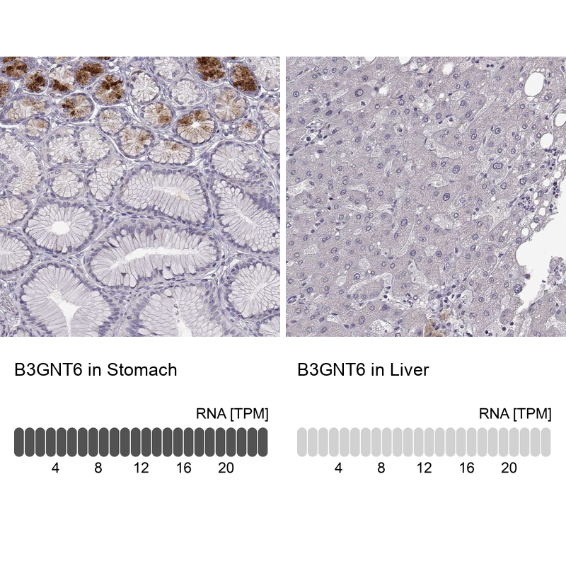 Anti-B3GNT6 Antibody