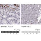 Anti-B3GNT6 Antibody