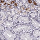 Immunohistochemical staining of human stomach shows high expression.