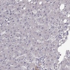 Anti-B3GNT6 Antibody