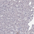 Immunohistochemical staining of human liver shows low expression as expected.