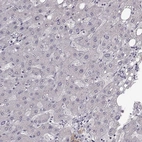 Immunohistochemical staining of human liver shows low expression as expected.