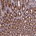 Anti-PTPRU Antibody