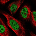 Immunofluorescent staining of human cell line U-2 OS shows localization to nucleoplasm.