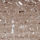 Immunohistochemical staining of human cerebral cortex shows strong granular cytoplasmic positivity in neurons.