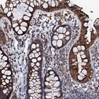 Immunohistochemical staining of human colon shows strong granular cytoplasmic positivity in glandular cells.