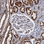 Immunohistochemical staining of human kidney shows strong granular cytoplasmic positivity in cells in tubules.