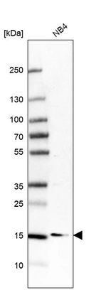 Western blot analysis in human cell line NB4.