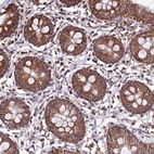 Anti-NDUFAF1 Antibody